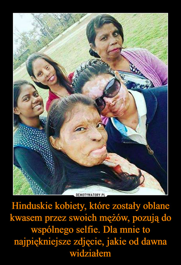 Hinduskie kobiety, które zostały oblane kwasem przez swoich mężów, pozują do wspólnego selfie. Dla mnie to najpiękniejsze zdjęcie, jakie od dawna widziałem