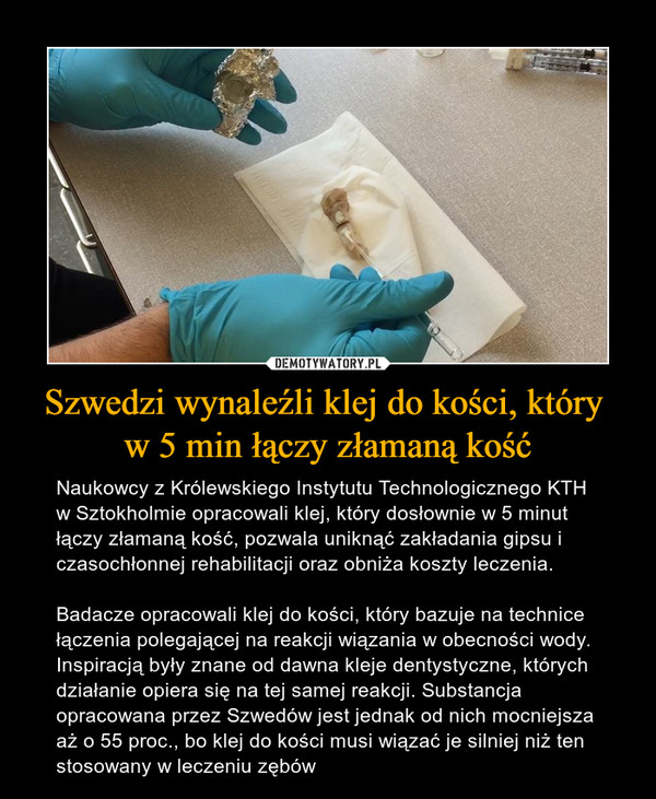 Szwedzi wynaleźli klej do kości, który w 5 min łączy złamaną kość – Naukowcy z Królewskiego Instytutu Technologicznego KTH w Sztokholmie opracowali klej, który dosłownie w 5 minut łączy złamaną kość, pozwala uniknąć zakładania gipsu i czasochłonnej rehabilitacji oraz obniża koszty leczenia.Badacze opracowali klej do kości, który bazuje na technice łączenia polegającej na reakcji wiązania w obecności wody. Inspiracją były znane od dawna kleje dentystyczne, których działanie opiera się na tej samej reakcji. Substancja opracowana przez Szwedów jest jednak od nich mocniejsza aż o 55 proc., bo klej do kości musi wiązać je silniej niż ten stosowany w leczeniu zębów 