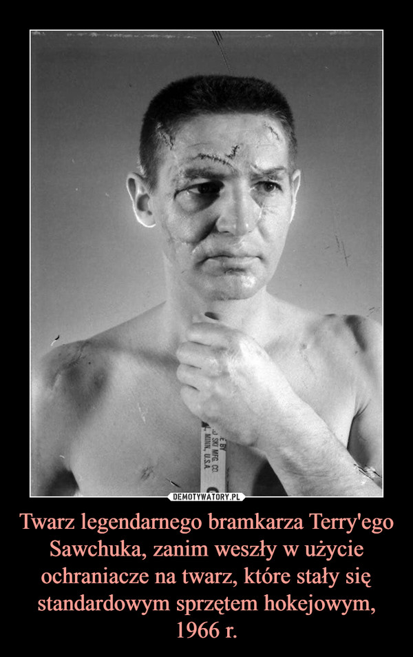 Twarz legendarnego bramkarza Terry'ego Sawchuka, zanim weszły w użycie ochraniacze na twarz, które stały się standardowym sprzętem hokejowym, 1966 r. –  
