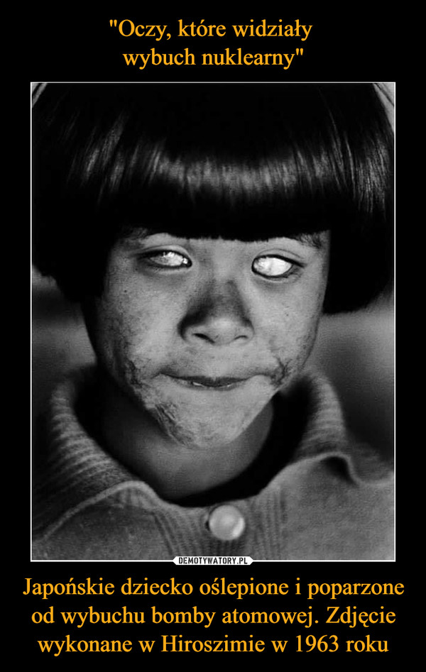 "Oczy, które widziały 
wybuch nuklearny" Japońskie dziecko oślepione i poparzone od wybuchu bomby atomowej. Zdjęcie wykonane w Hiroszimie w 1963 roku