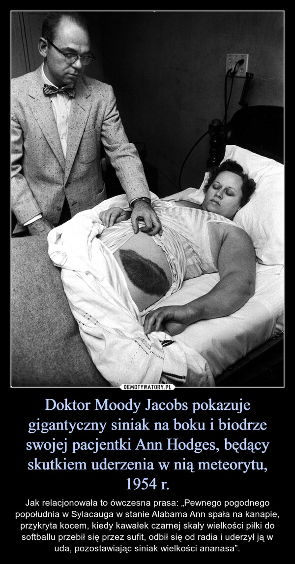 Doktor Moody Jacobs pokazuje gigantyczny siniak na boku i biodrze swojej pacjentki Ann Hodges, będący skutkiem uderzenia w nią meteorytu, 1954 r.