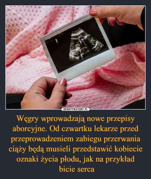 Węgry wprowadzają nowe przepisy aborcyjne. Od czwartku lekarze przed przeprowadzeniem zabiegu przerwania ciąży będą musieli przedstawić kobiecie oznaki życia płodu, jak na przykład
 bicie serca